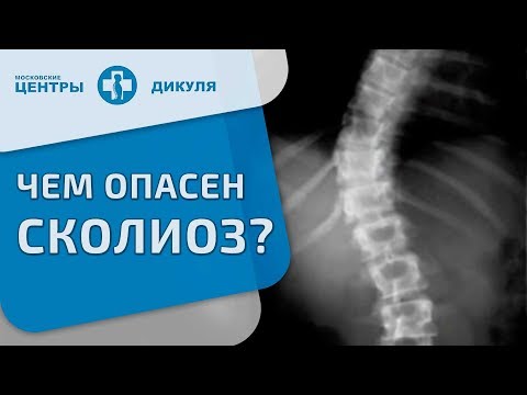 Упражнения на укрепления осанки Жесткий корсет для исправления осанки