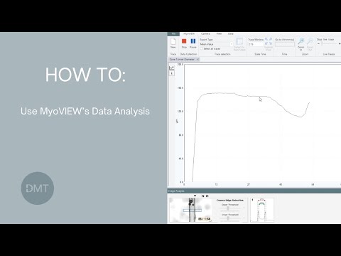 DMT MyoVIEW data analysis workflow