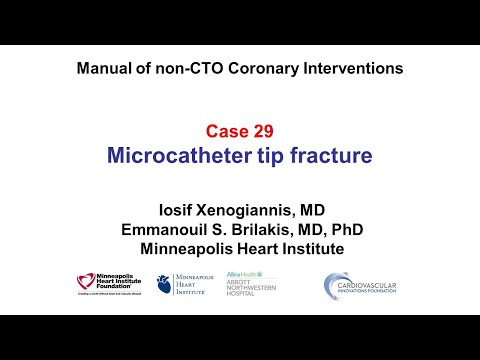 Case 29: PCI Manual: Microcatheter tip fracture