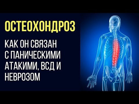 У бройлеров опухают суставы ног Средства от остеофитов в коленном суставе