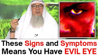 Download lagu Symptoms and Signs of Evil Eye and How to Cure From Evil Eye With Ruqyah | Sheikh Assim Al Hakeem mp3