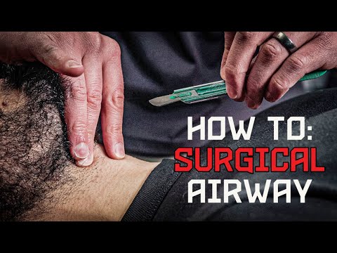 How to: Emergency Surgical Cricothyrotomy