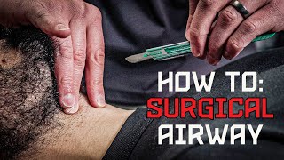 How to: Emergency Surgical Cricothyrotomy