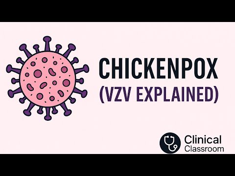 Chickenpox (Varicella-Zoster Virus) Explained | Symptoms, Pathogenesis & MBBS Notes