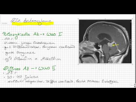 Einteilung der Hirntumore Teil 1