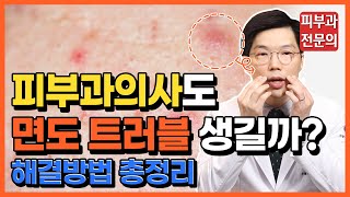 면도트러블 해결하는 방법(feat 일회용 면도기는 몇 번까지 쓸까?)