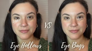 Eye Hollows vs Eye Bags: Why Other Under-Eye Concealer Tutorials Have Failed You…