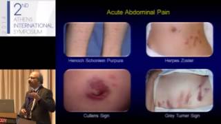 Prof. Nageshwar Reddy, Hyderabad, India - Approach to abdominal pain