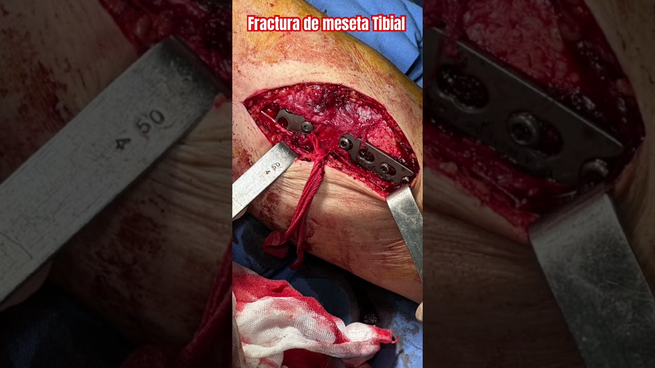 Carlos Tapia Hernández-18