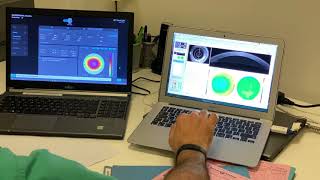 Download Lagu InnovEyes: Introduction of customised LASIK ablations using Artificial Intelligence from Athens! Thumbnail