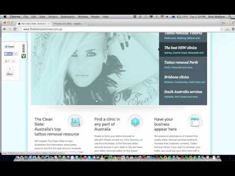download lagu mp3 mp4 Tattoo Removal Bendigo, download mp3 Tattoo Removal Bendigo free download mp3, download mp3 Tattoo Removal Bendigo
