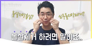 볼살제거 하려면 '볼살지방흡입vs심부볼지방제거' 어떤걸 해야지?