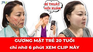 Bác sĩ Tú Dung CÔNG BỐ bí kíp HẾT GIÀ với Căng da mặt Mesh Lift cho quý cô TRUNG NIÊN