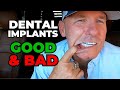 The GOOD and BAD Of My Dental Implants After 2 Years