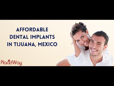 Watch Dental Implants in Tijuana, Mexico