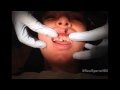 Christy Mack’s Reconstructive Dental Work: Real Sports Bonus Clip (HBO)