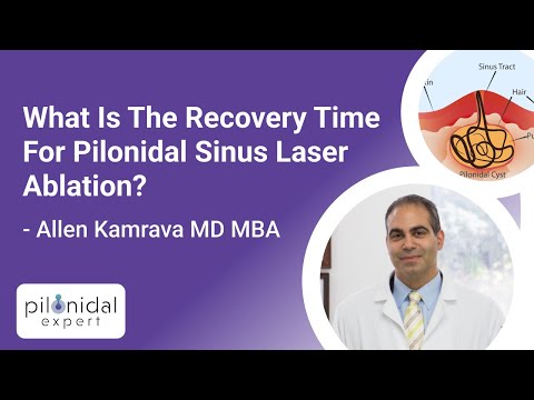 What Is The Recovery Time For Pilonidal Sinus Laser Ablation? Pilonidal Expert