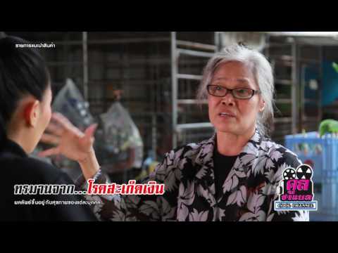 โลชั่นสำหรับโรคสะเก็ดเงิน เพราะสิ่งที่ออกมาจากแผลเปื่อยมา