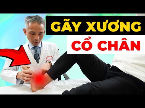 Gãy Xương Cổ Chân Sau Mổ Nhưng Đau Đớn Kéo Dài? - Cách Phục Hồi Đúng