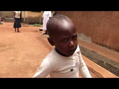 Kinderoperation Ashia Kamerun Enendey Rachitis-Erkrankung