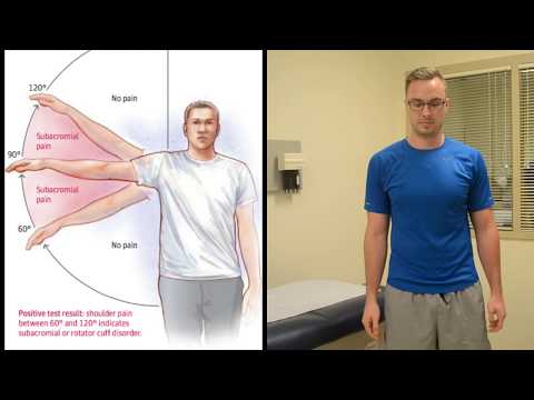 Painful Arc - Rotator Cuff Impingement