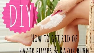 How to Get Rid of Razor Bumps and Razor Burn! | DIY