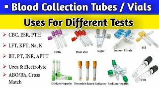 Download lagu Blood Collection Tubes || Types Colors & Uses for different Tests mp3 Download lagu Blood Collection Tubes || Types Colors & Uses for different Tests mp3