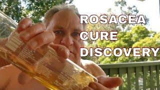 ROSACEA CURE DOCTORS WONT TELL YOU NEW CURE FOR ROSACEA