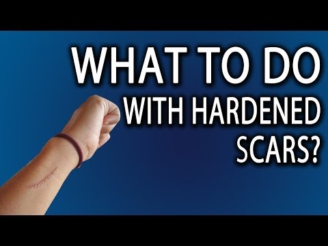 How To Heal Hardened Scar Tissue