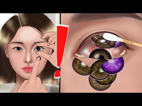 ASMR Removal of many contact lenses from the eye👁 Animation, oshi no ko
