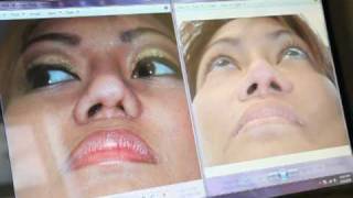 Dr. Behrooz Torkian Facial Plastic Surgery