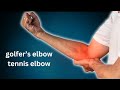 Watch This To Fix Elbow Pain