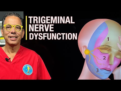 Trigeminal nerve dysfunction - Ross Hauser, MD