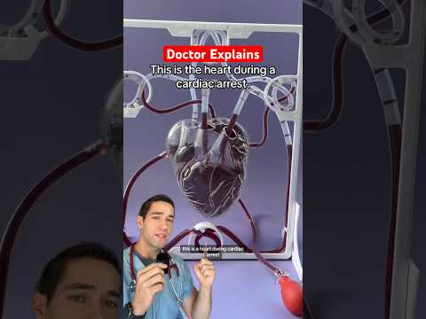 This is what cardiac arrest looks like