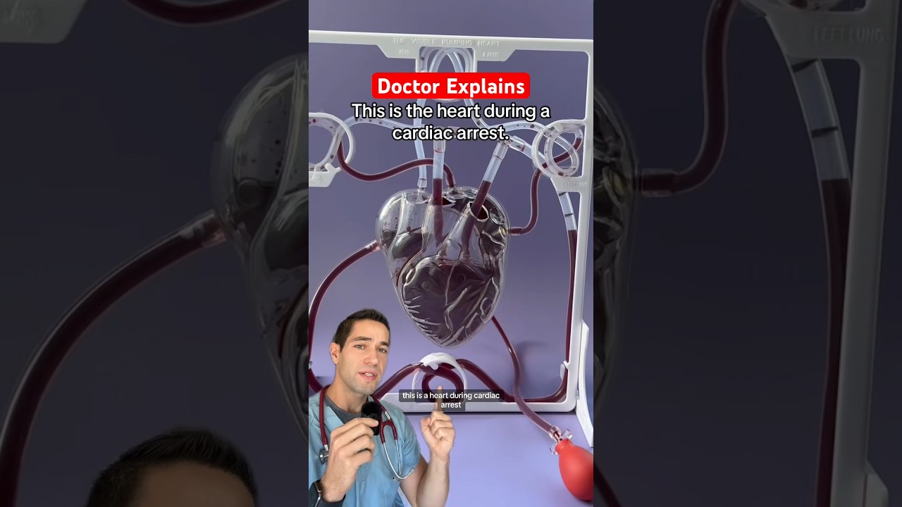 This is what cardiac arrest looks like