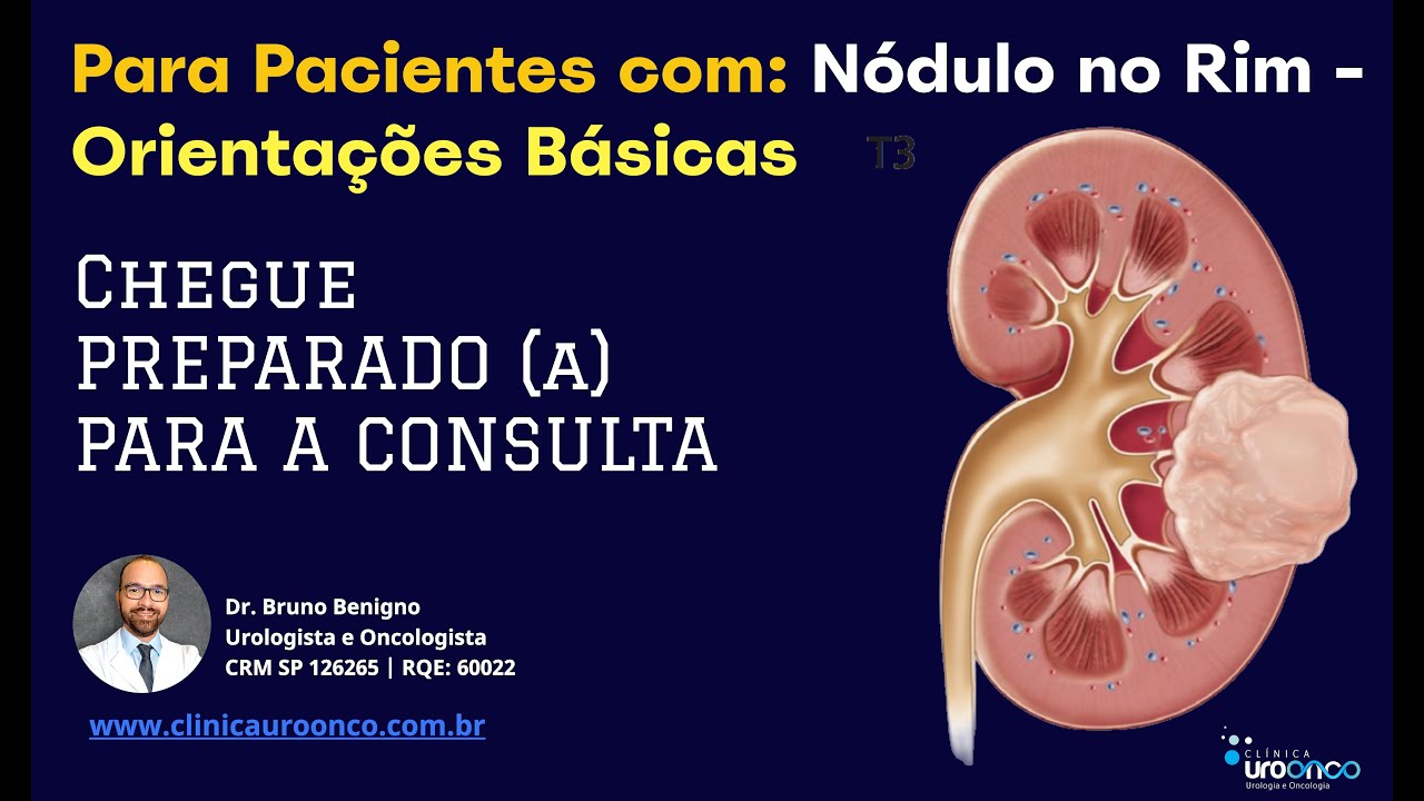 Tenho um Nódulo no Rim | prepare-se para sua consulta  | Informações importantes antes de tratar