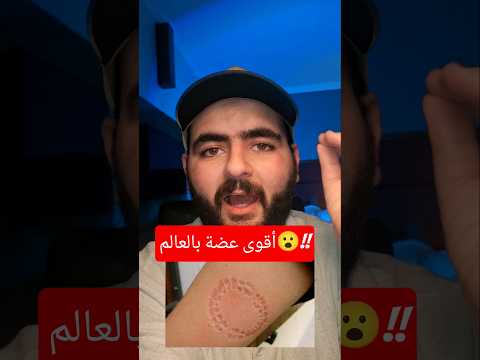 أقوى عضة بالعالم رح تتفاجئ بس تعرف مين طلع أخر شي!!!!|أيمن تيوبر