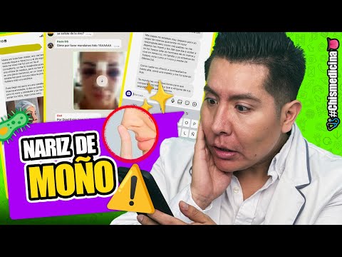 LA NARIZ DE MOÑO | #CHISMEdicina | Mr Doctor