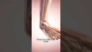 What Happens Inside a Sprained Ankle