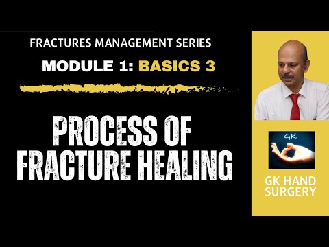 Hand fractures: Basics 3 - Processes of fracture healing - Direct and indirect healing phases.