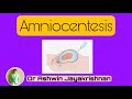 Amniocentesis | Dr Ashwin Jayakrishnan |
