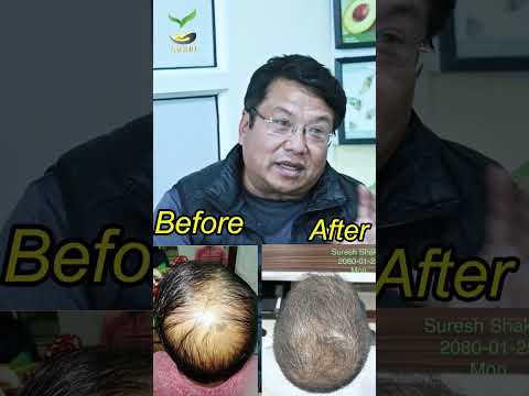 Suresh Shakya, our satisfied customer, expressed his emotions.l | Yachu Hair Oil