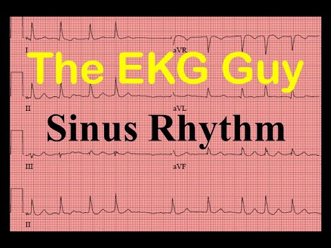 EKG/ECG Sinus Rhythm - Question 14.0 | The EKG Guy