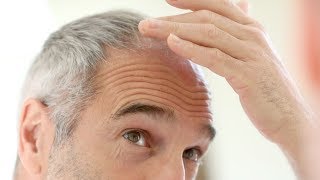 Vindecarea alopeciei: episodul 1