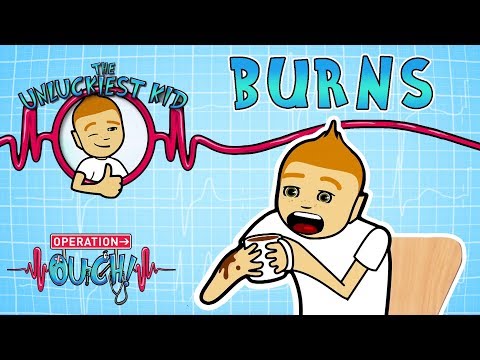 Science for kids - Bad Burns | Experiments for kids | Operation Ouch