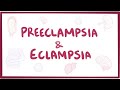 Preeclampsia Eclampsia Causes Symptoms Diagnosis Treatment Pathology
