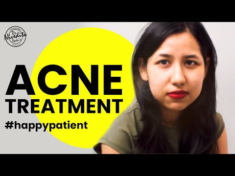Acne Treatment (Patient from Assam) | Dr. Nivedita Dadu | Best Dermatologist
