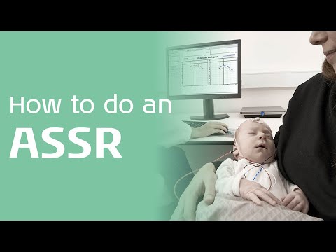 Performing an ASSR Threshold Assessment