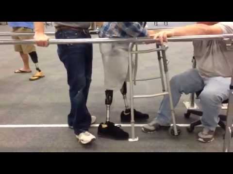 77 and Learning to Walk on 2 Prosthetic Legs: No Boundaries!