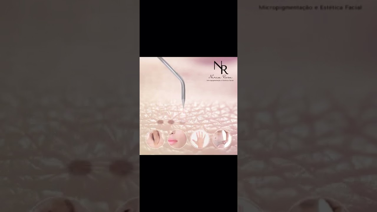 Biomédica catarinense ganha destaque internacional com técnica refinada e pesquisa científica sobre bioestimuladores de colágeno